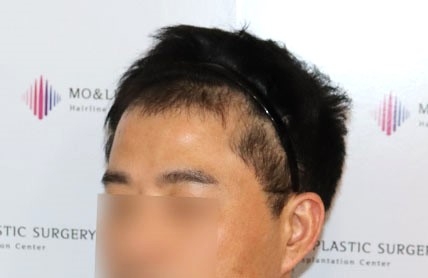 치료후기 이미지